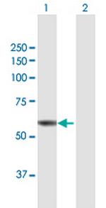 ST7 Polyclonal Antibody, MaxPab™