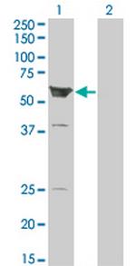 ARHGEF5 Monoclonal Antibody (3A12-B5)