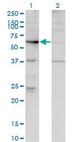 ARHGEF5 Monoclonal Antibody (4D10-D11)