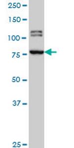 BRD3 Monoclonal Antibody (6E7)