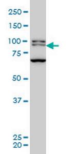 BRD3 Monoclonal Antibody (6C10)