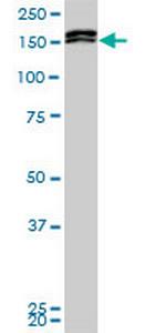 MLLT10 Monoclonal Antibody (6H8)