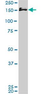 MLLT10 Antibody in Western Blot (WB)