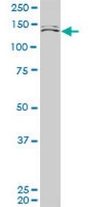 MLLT10 Antibody in Western Blot (WB)