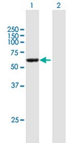 CCDC6 Polyclonal Antibody, MaxPab™