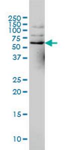 NCOA4 Monoclonal Antibody (1A2)