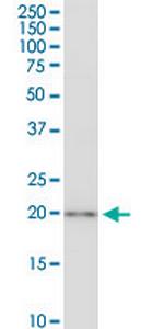 CSRP3 Monoclonal Antibody (6D2)