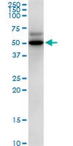 PDHX Polyclonal Antibody, MaxPab™