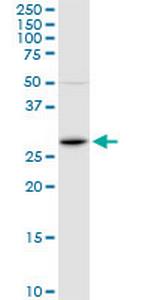 FOSL1 Polyclonal Antibody, MaxPab™
