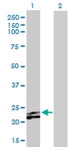 FGF23 Antibody in Western Blot (WB)