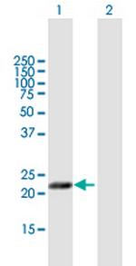 MFAP5 Polyclonal Antibody, MaxPab™