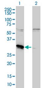 MLF2 Monoclonal Antibody (2F6-1E3)