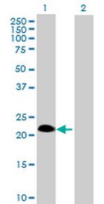 SSPN Antibody in Western Blot (WB)