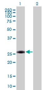 AAAS Polyclonal Antibody, MaxPab™