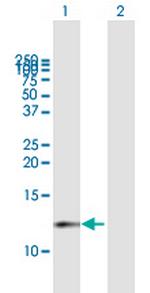 CDK2AP1 Antibody in Western Blot (WB)