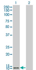 TCL1A Monoclonal Antibody (3G10)