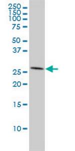 ANP32A Monoclonal Antibody (2G11-4A5)
