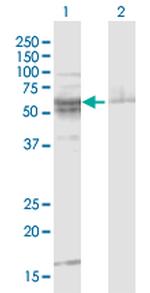 ST8SIA2 Polyclonal Antibody, MaxPab™
