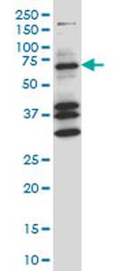 COIL Antibody in Western Blot (WB)