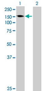 AKAP1 Antibody in Western Blot (WB)