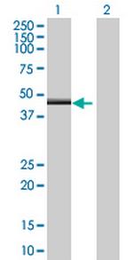 ZNF239 Polyclonal Antibody, MaxPab™