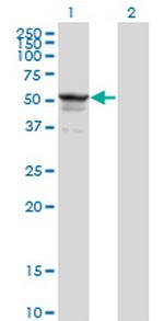 SYMPK Monoclonal Antibody (4C2)