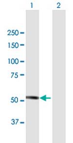 MKKS Polyclonal Antibody, MaxPab™