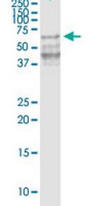 GDF5 Monoclonal Antibody (1F4)