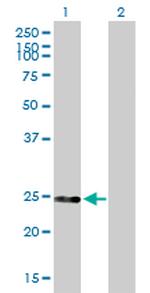 DGCR6 Antibody in Western Blot (WB)