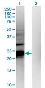 HDHD1A Monoclonal Antibody (4F12)