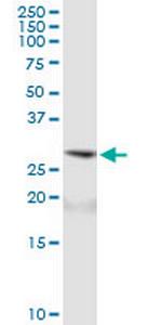 ARD1A Polyclonal Antibody, MaxPab™