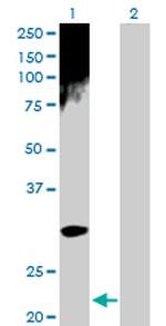 ARD1A Polyclonal Antibody, MaxPab™