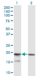KLRC4 Monoclonal Antibody (1D10)