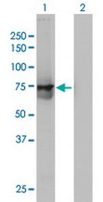 ACOX2 Monoclonal Antibody (1D1)