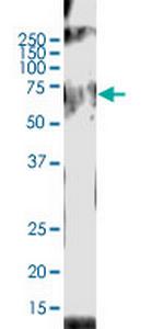 ACOX2 Monoclonal Antibody (1A7)
