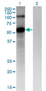 FZD4 Monoclonal Antibody (3G7)