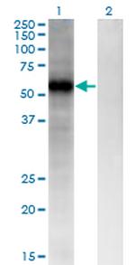 FZD4 Antibody in Western Blot (WB)