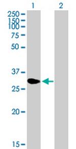 NME5 Polyclonal Antibody, MaxPab™