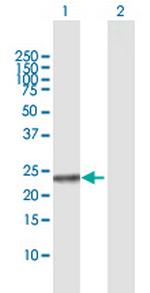 NME5 Polyclonal Antibody, MaxPab™