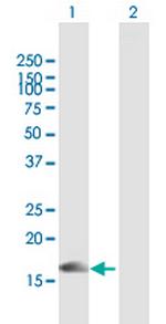 PLA2G10 Antibody in Western Blot (WB)