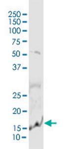 PLA2G10 Antibody in Western Blot (WB)