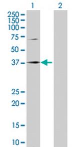 SPOP Polyclonal Antibody, MaxPab™