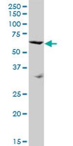 SRPX Antibody in Western Blot (WB)