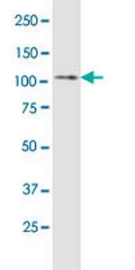 ULK1 Monoclonal Antibody (2H8)