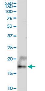 UXT Polyclonal Antibody, MaxPab™