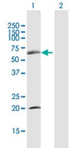 SDPR Polyclonal Antibody, MaxPab™