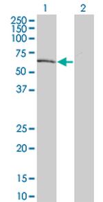 DYRK2 Antibody in Western Blot (WB)