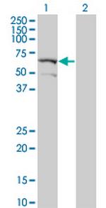 DYRK2 Monoclonal Antibody (2F9)