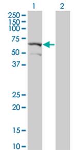 DYRK2 Antibody in Western Blot (WB)