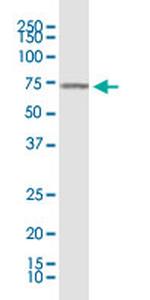 KLF11 Antibody in Western Blot (WB)